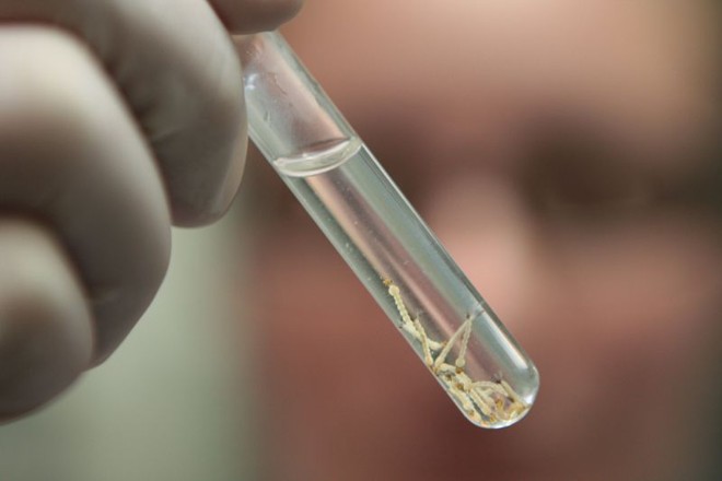 Larvas do Aedes aegypti recolhidas por técnicos da vigilância: Jacarezinho decretou estado de emergência após a ocorrência de duas mortes | 