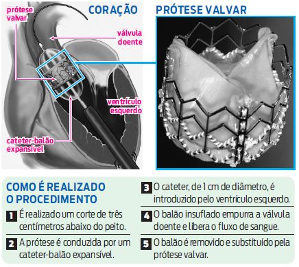 Veja como é feito o procedimento |