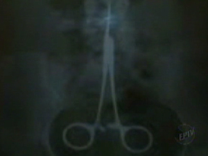 Tesoura foi esquecida em paciente | Foto: Reprodução/EPTV