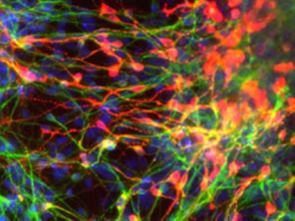 Células-tronco adultas geradas a partir da técnica desenvolvida por Kang Zhang e colegas nos EUA | Universidade da Califórnia, San Diego
