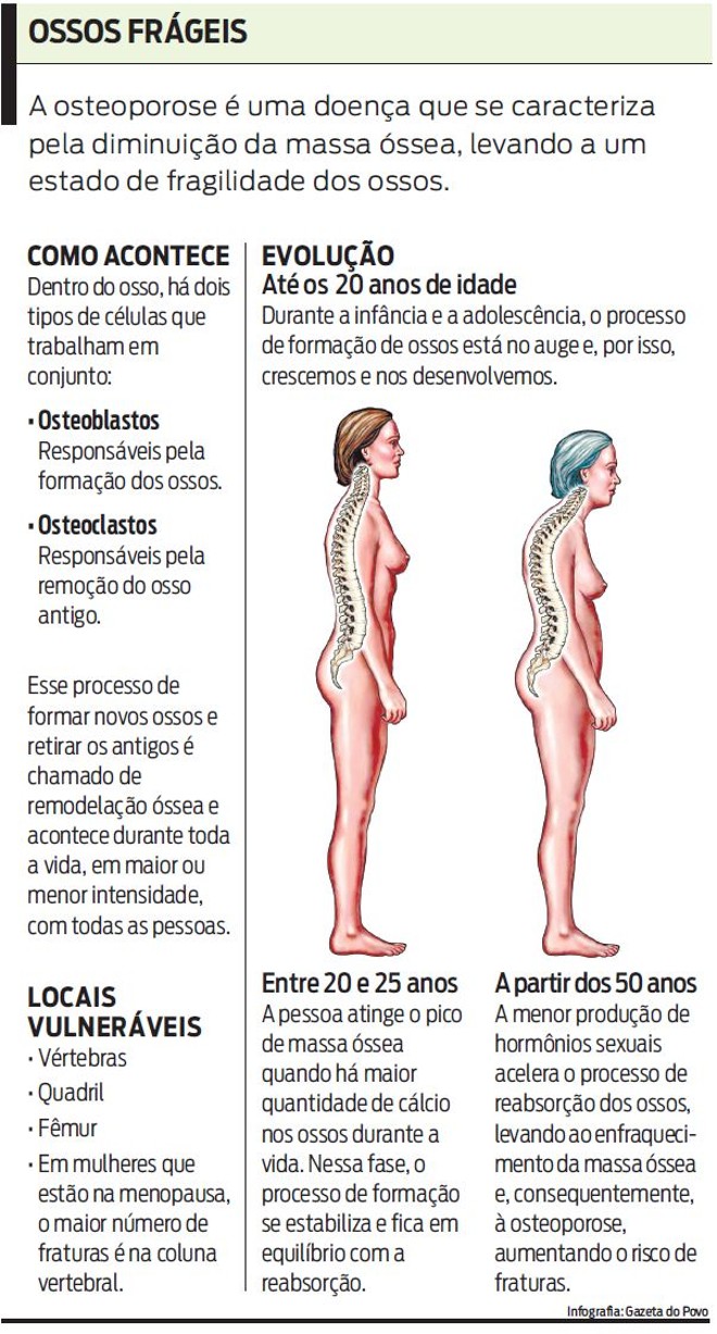 Veja como acontece a osteoporose | 