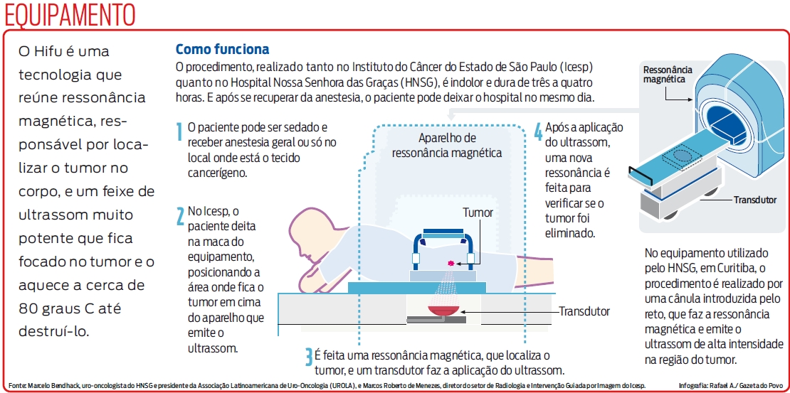 Veja como funciona o Hifu |