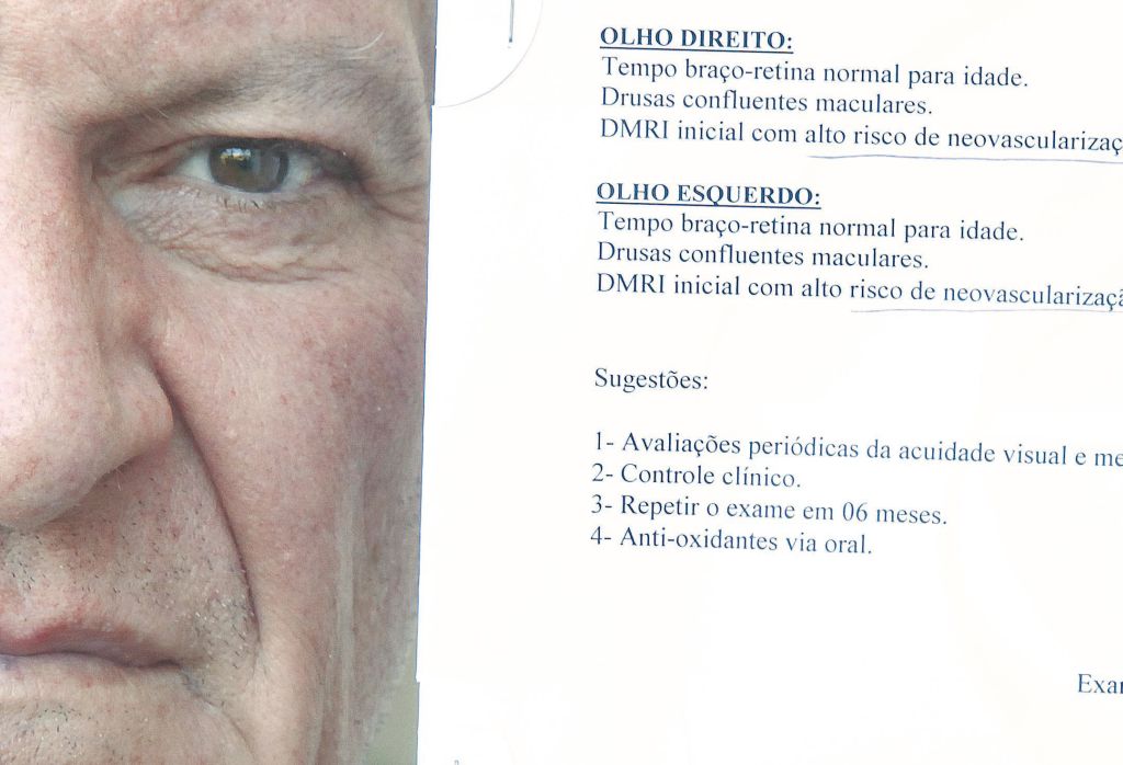 O aposentado Milton Marques Filho, está pedindo reembolso ao plano de saúde por uma tomografia de retina: ele teve de pagar R$ 300 pelo exame, que não é coberto | Jonathan Campos/Gazeta do Povo