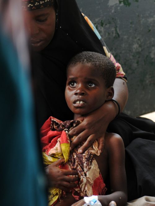 Criança somali é recebida por médicos em um hospital de Mogadíscio | Roberto Schmidt/AFP