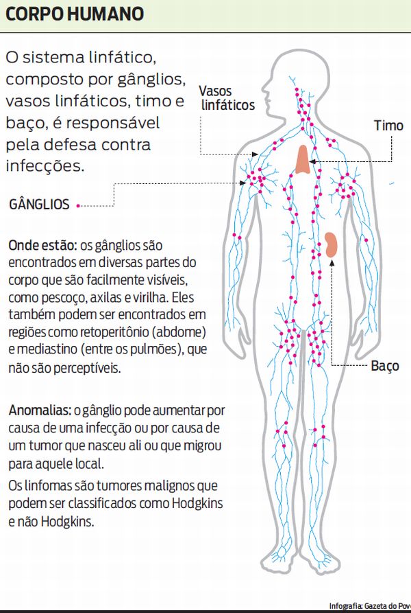 Entenda como e onde acontecem os linfomas no corpo humano |