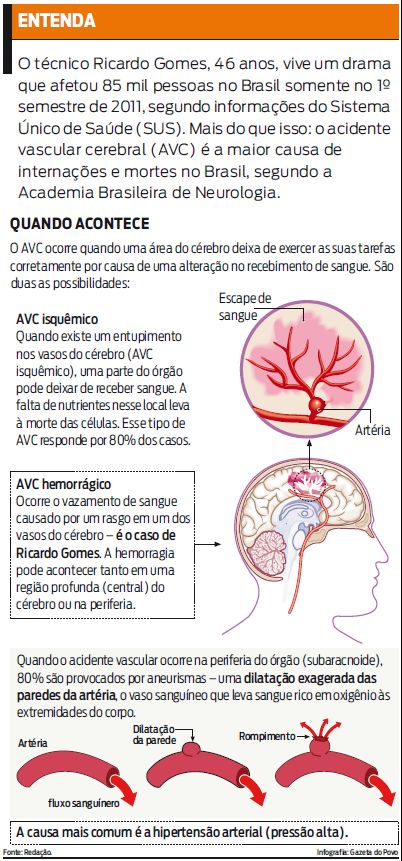Entenda o que é um acidente vascular cerebral (AVC) |
