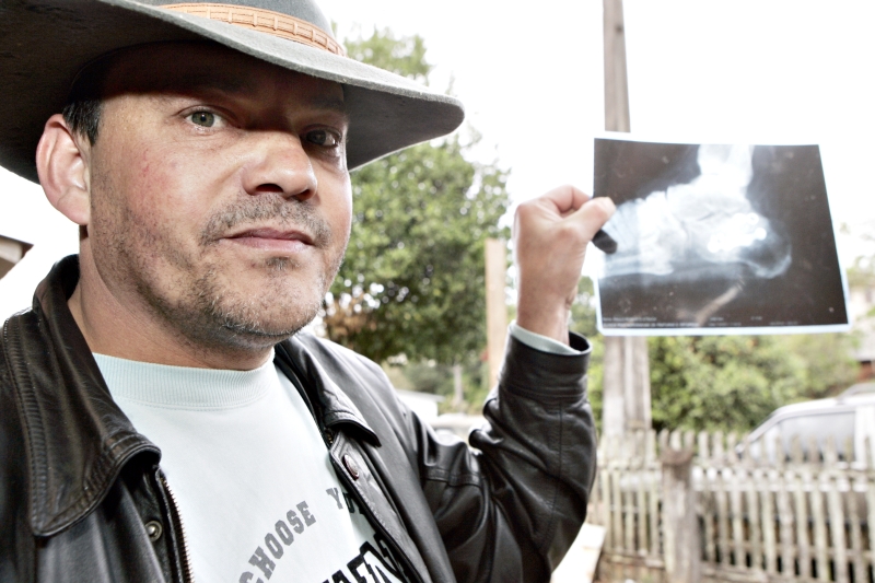 Paulo Strack desistiu de operar o calcanhar pelo SUS após quase um mês de espera e resolveu pagar pela operação | Henry Milléo/Gazeta do Povo