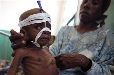 Mulher atende o filho no hospital Banadir, em Mogadíscio, capital da Somália, nesta terça-feira | Reuters