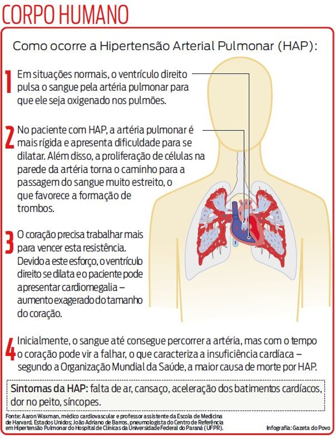 Entenda como ocorre a Hipertensão Arterial Pulmonar | 