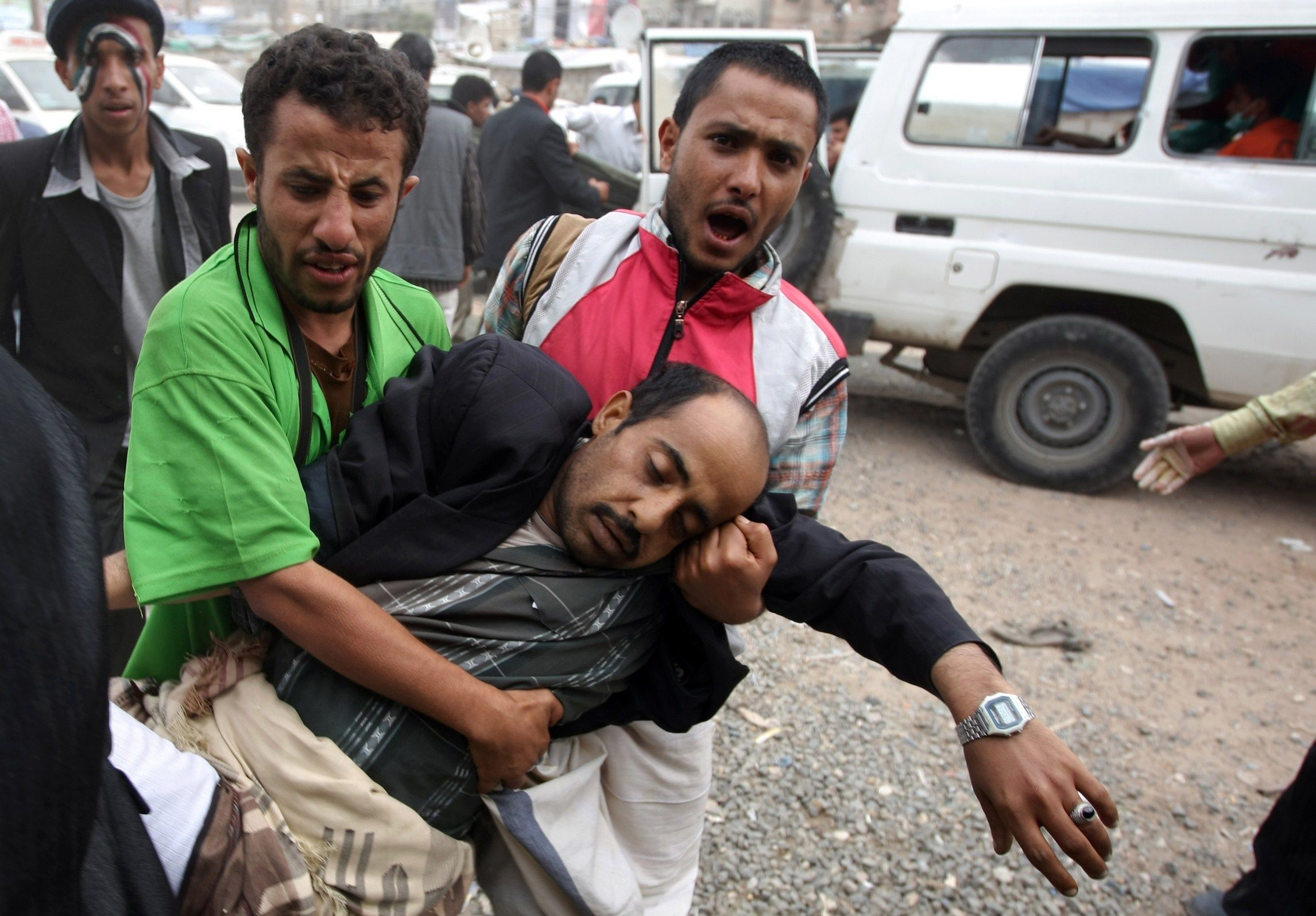 Iemenita ferido é socorrido. favoráveis do regime de Saleh atiraram em vários manifestantes a favor da renúncia nesta quinta | AFP PHOTO/ MOHAMMED HUWAIS