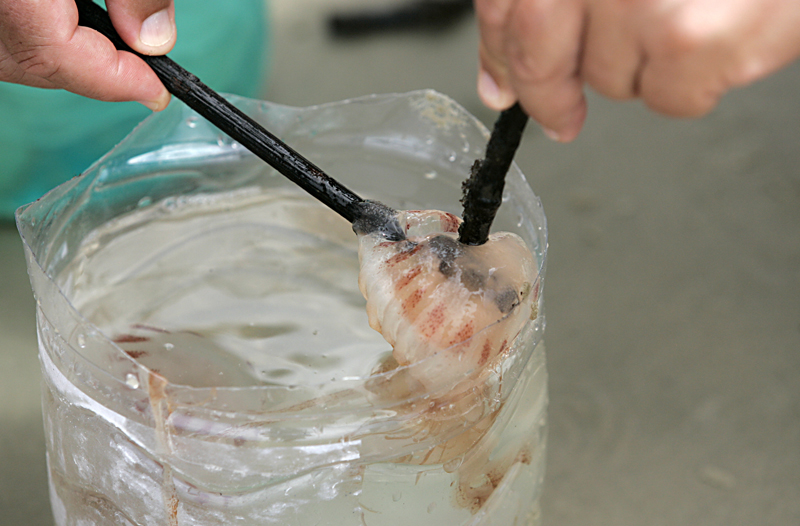 As águas-vivas continuam queimando os veranistas que entram no mar. Desde o início da temporada, há mais de 6 mil casos registrados pelo Corpo de Bombeiros | Marco André Lima/Agência de Notícias Gazeta do Povo