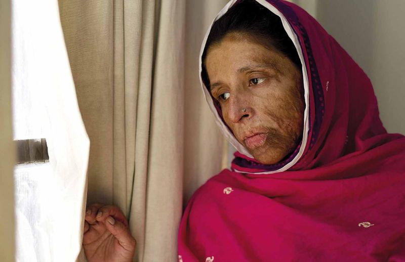 Saving Face retrata o drama vivido por mulheres paquistanesas agredidas no país asiático | Divulgação