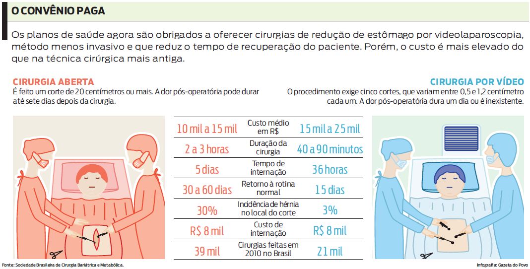 Infográfico: Planos de saúde são obrigados a oferecer cirurgias de redução de estômago |
