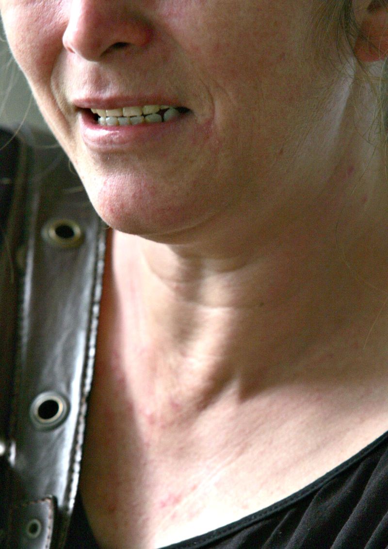 Internação nem sempre é o melhor remédio -Paciente de um Centro de Atenção Psicossocial (Caps) em Ponta Grossa, nos Campos Gerais, Gisele (*) é um exemplo de que nem sempre a internação é o melhor remédio. Ela sofre de síndrome do pânico e depressão profunda e diz que já pensou em suicídio. Mãe de três filhos, casada e funcionária pública, procurou o Caps para se tratar. Faz um ano que estou aqui e estou melhorando muito. Tomo dois tipos de remédios todos os dias e ainda pratico atividades terapêuticas, como música e artesanato, afirma. Ela recebe tratamento psicológico e psiquiátrico uma vez por semana. Mesmo assim, Gisele também compartilha a percepção geral de que faltam locais para internar pacientes que sofrem surtos psíquicos. Precisa-se de mais leitos para diminuir a fila. Mas não pode ser aquele hospital estilo hospício, opina. * Nome fictício | Josué Teixeira/ Gazeta do Povo