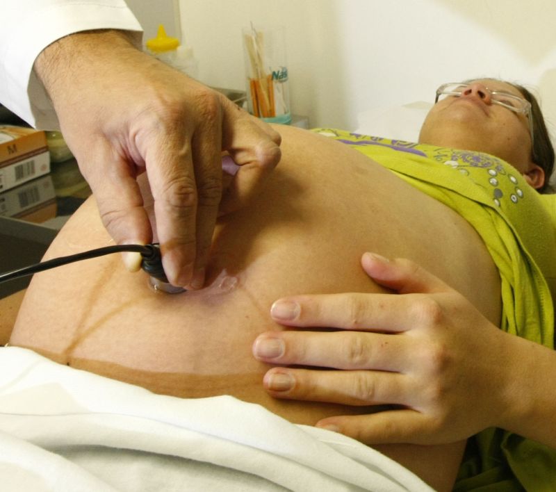 Grávida atendida pelo Mãe Curitibana: programa lançado em 1999 tem pontos em comum com o desenvolvido em 1993 | Marcelo Elias/ Gazeta do Povo