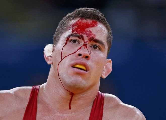 O venezuelano Ricardo Roberty Moreno sangra durante o combate com Augusto Midana, de Guiné-Bissau, na luta-livre até 74kg | 