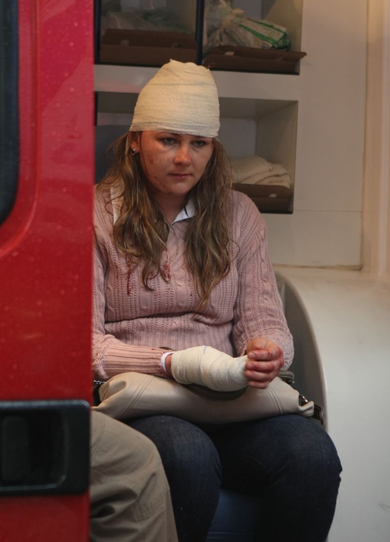 Roseli: cortes na cabeça e mão | Aniele Nascimento/ Gazeta do Povo