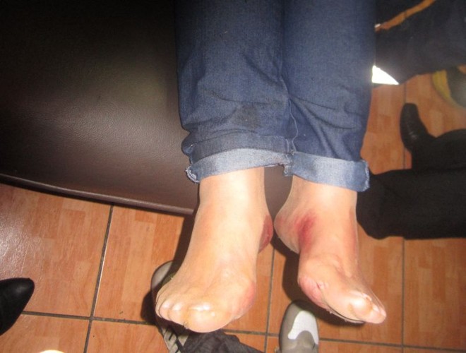 Pessoa é atendida pelos bombeiros após o desabamento de um camarote durante o show de Milionário e José Rico | 