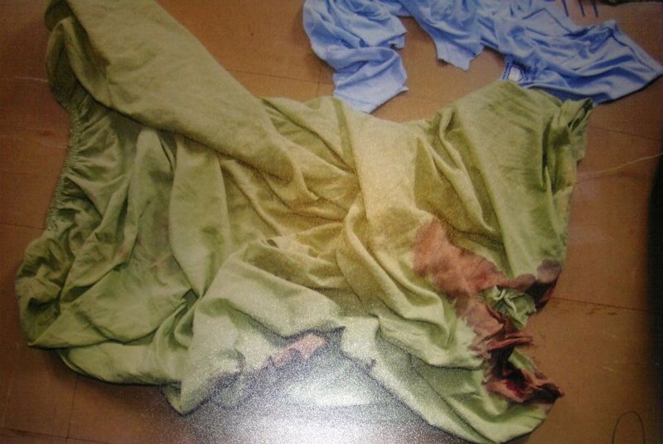 Nas fotos é possível visualizar vestígios do crime no que parece ser um lençol | Polícia Civil / Divulgação
