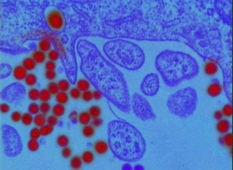 Durante a infecção pelo HIV, milhões de partículas virais estão presentes na corrente sanguínea | Boehringer Ingelheim