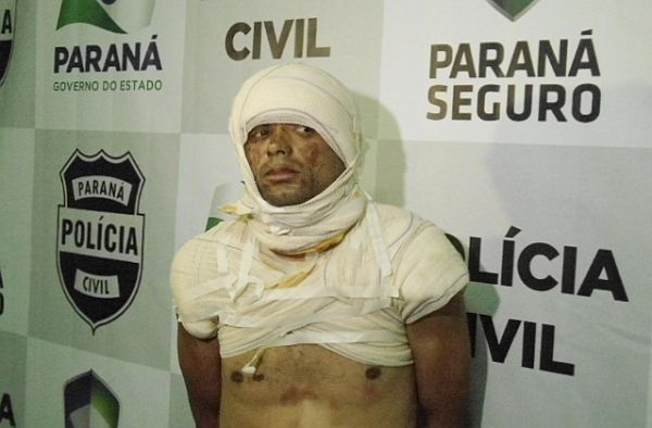 Homem foi encontrado no hospital com queimaduras no rosto e no tórax | Divulgação / Polícia Civil