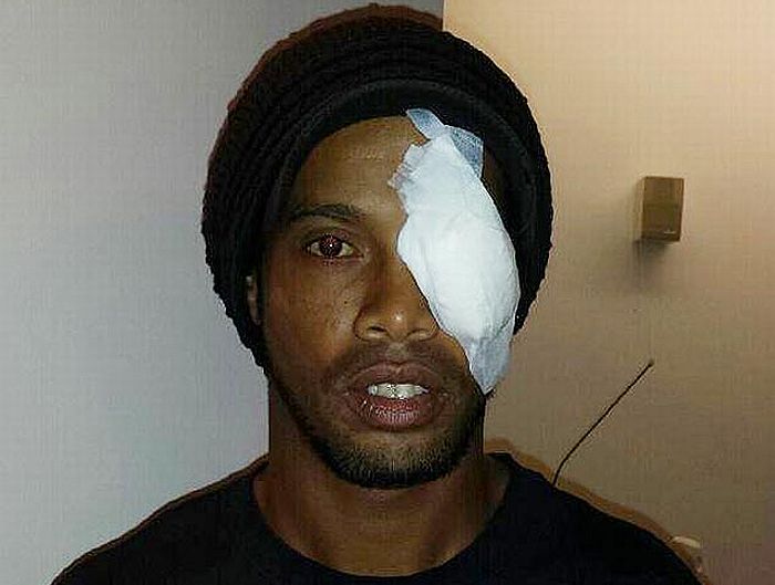 Por causa dos exames no olho, Ronaldinho não pôde receber prêmio de melhor jogador do Campeonato Mineiro | Reprodução/Twitpic/10Ronaldinho