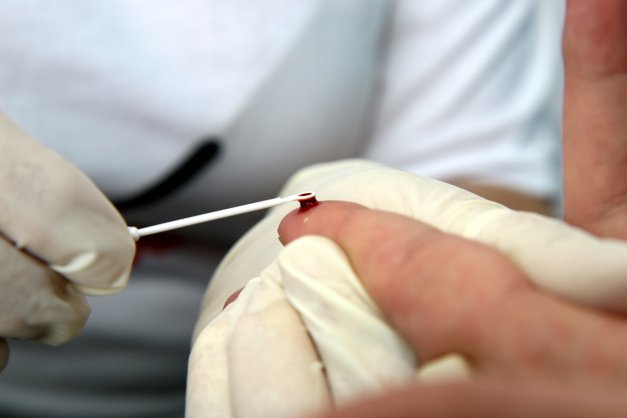 O teste que revela o resultado do HIV na hora pode ser feito em oito locais mantidos pela Prefeitura | Arquivo / Henry Milleo / Gazeta Do Povo