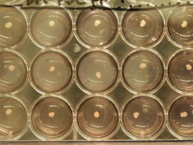 Células-tronco dão origem a broto de fígado | TakanoriTakebe/Divulgação