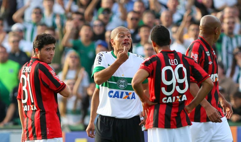 Alex, com o nariz sangrando após uma dividida, discute com os atleticanos Zezinho, Léo e Luiz Alberto | Daniel Castellano/ Gazeta do Povo