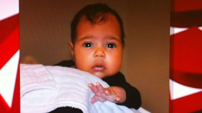 Foto divulgada de North West, filha de Kanye West e Kim Kardashian | Reprodução / Fox News