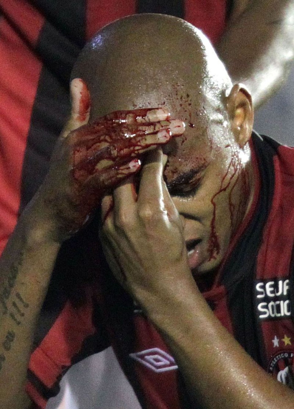 O zagueiro Luiz Alberto sofreu um corte profundo na cabeça e deixou o Atlético ainda mais desfalcado no empate com o Vasco | Marcos de Paula/Estadão Conteúdo