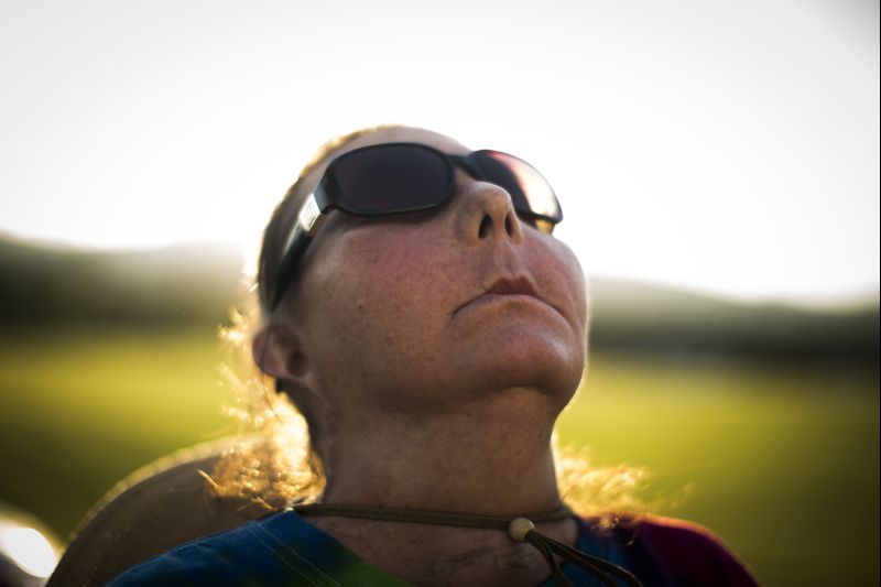 Depois de ser desfigurada pelo marido, Carmen recebeu rosto transplantado | Leslye Davis/The New York Times