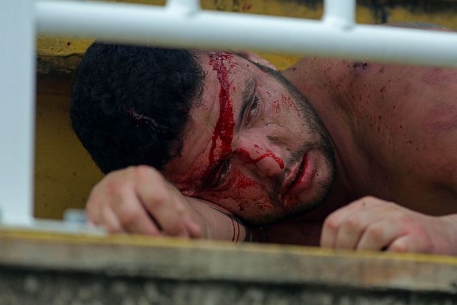 Torcedor ficou ensanguentado após a guerra entre torcidas do Atlético e Vasco | 