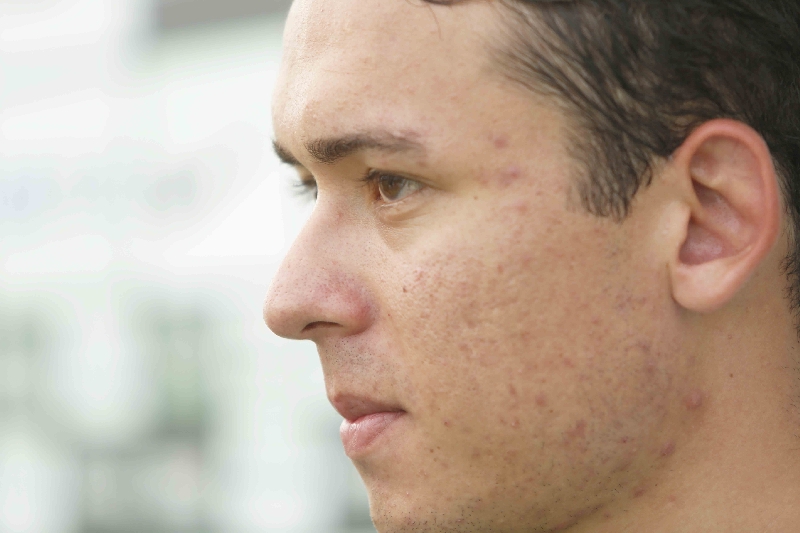 Keirrison receberá homenagens da diretoria do Cene | Marcelo Andrade/ Gazeta do Povo