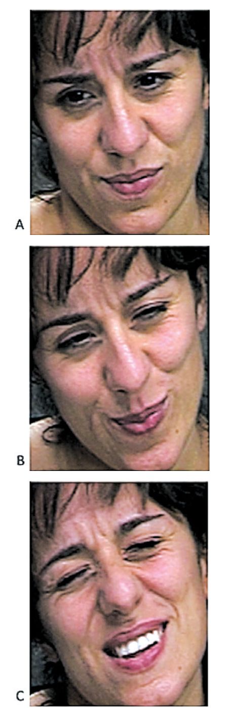 Quais expressões mostram dor real e quais são fingidas? Respostas: a) falso; b) real, c) real | Kang Lee, Marian Barlett