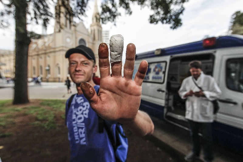 Paciente mostra curativo nas mãos queimadas: remédio passa por cuidados básicos e papo | Fotos: Daniel Castellano/Gazeta do Povo