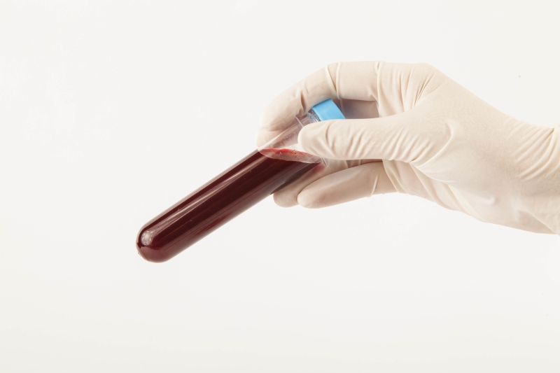 | Fernando Zequinão/ Gazeta do Povo