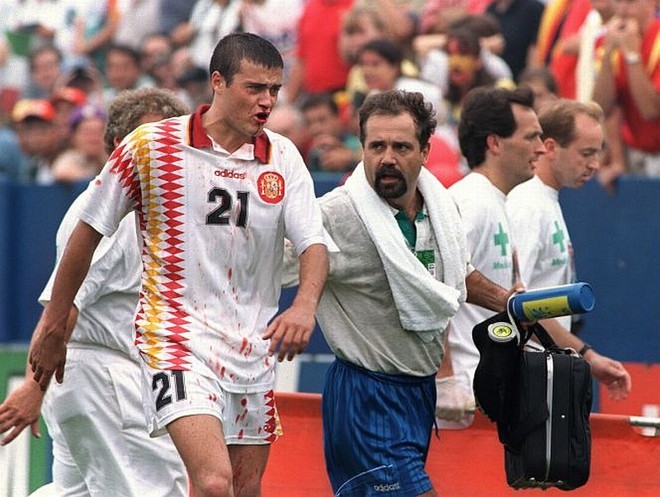 Luis Enrique-1994:Nas quartas de final de 1994, perto do fim do jogo da Espanha contra a Itália, o meia Luis Enrique sofreu uma cotovelada do zagueiro italiano Mauro Tassotti. O árbitro do jogo não viu a agressão e o jogo seguiu com o espanhol saindo com o nariz quebrado. A Itália venceu por 2 a 1, mas Tassotti foi punido com nove jogos de suspensão. | 