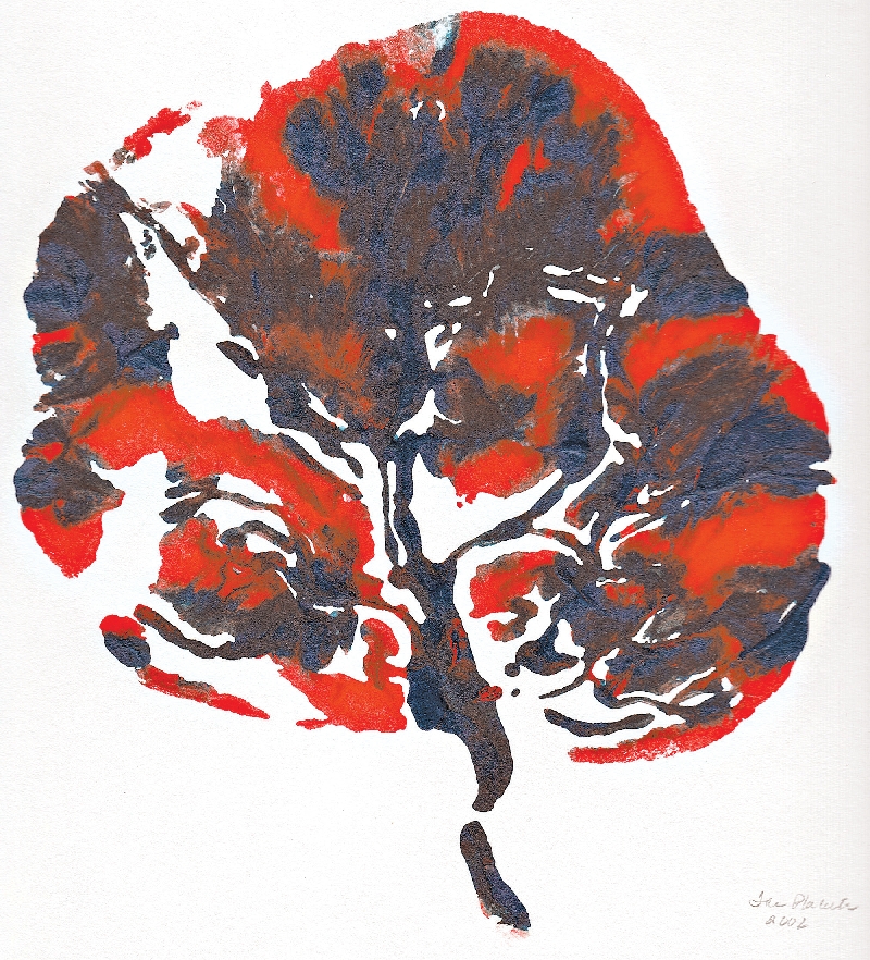 Imagem de placenta, feita a tinta; órgão pode influenciar saúde do bebê e ao longo de sua vida | Michael McMaster