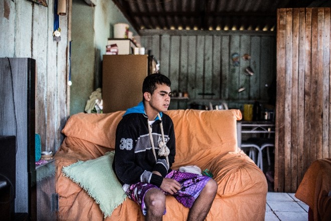 O adolescente quebrou o úmero durante acidente com moto em maio | 