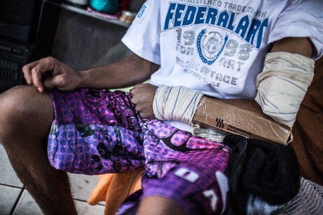 Tala improvisada com papelão no braço esquerdo de Jean Carlos | 