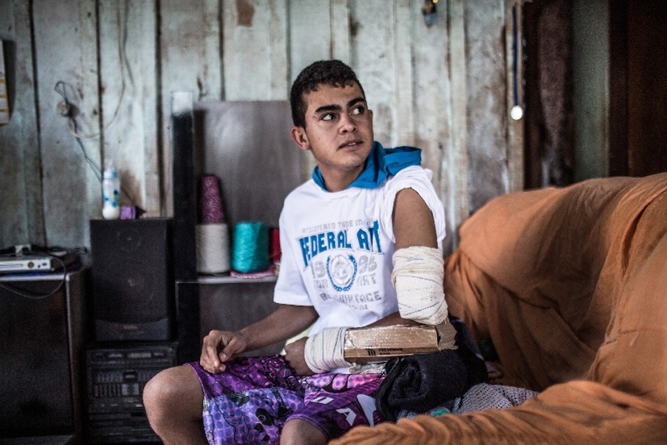 Jean Carlos de Lima dos Santos,16 anos, demorou quatro meses para acabar com as dores no braço quebrado | Brunno Covello/ Gazeta do Povo