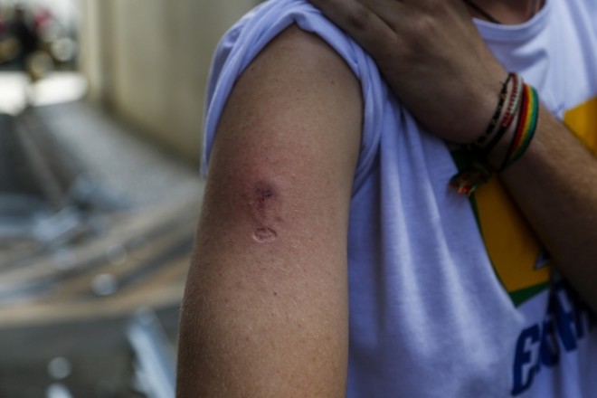 Gás, spray de pimenta e balas de borracha foram usados para dispersar o protesto |