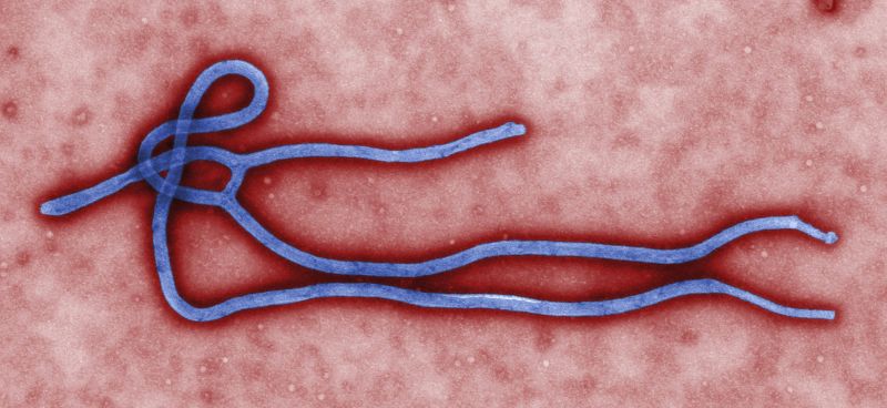 Vírus ebola | Cynthia Goldsmith/EFE