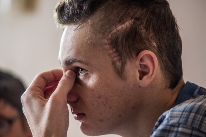 Maicon Schreiner, morador de Teixeira Soares e um Acidente Vascular Cerebral (AVC) aos 20 anos |