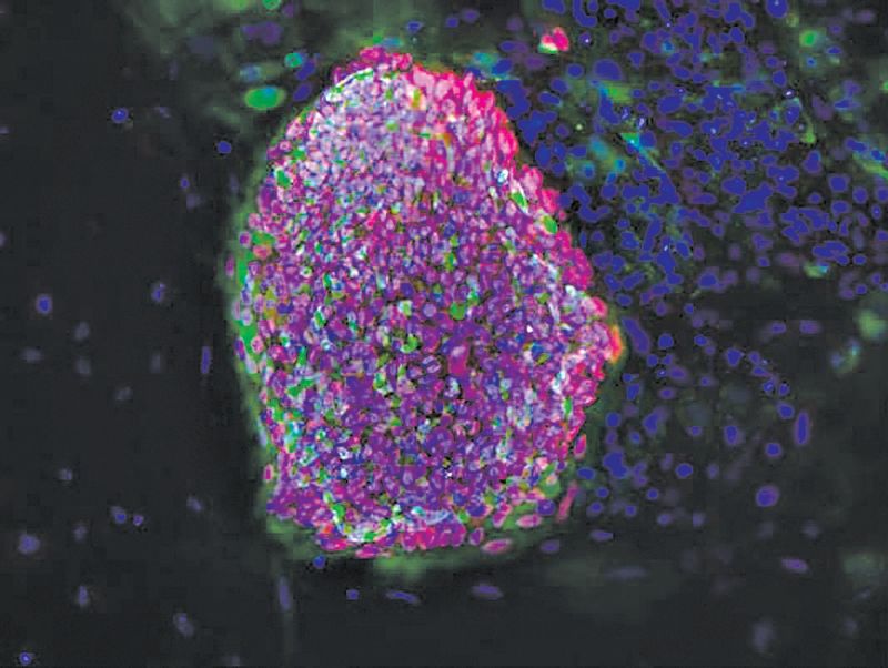Células-tronco embrionárias foram induzidas a se tornar células fabricantes de insulina, a serem implantadas em diabéticos | Bjarki Johannesson/NYSCF, via Reuters
