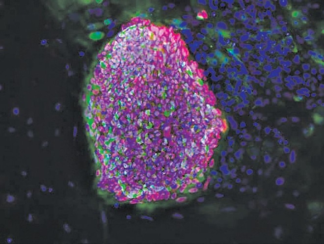 Células-tronco embrionárias foram induzidas a se tornar células fabricantes de insulina, a serem implantadas em diabéticos | Bjarki Johannesson/NYSCF, via Reuters