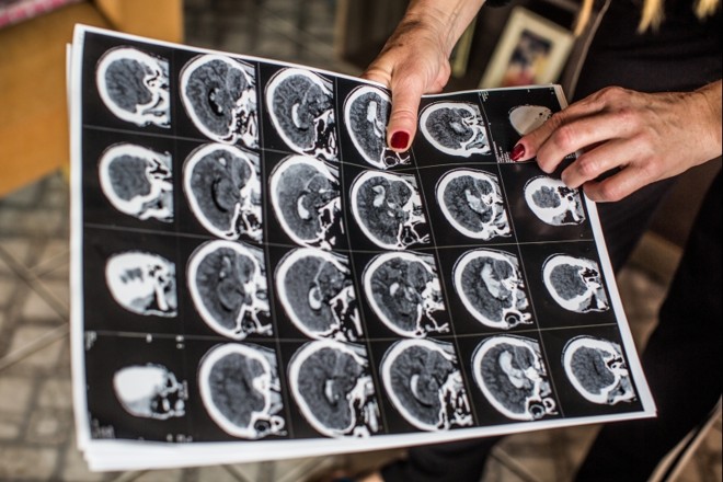 Detalhe de um dos exames de Maicon |