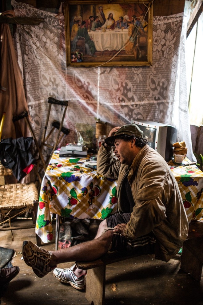 O agricultor foi atropelado e quebrou uma das pernas. A outra havia sido quebrada em 2006 enquanto ele transportava 60 quilos de feijão nas costas |