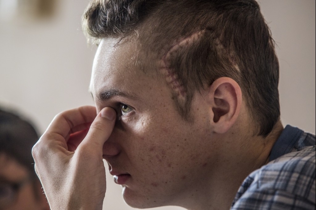 Maicon Schreiner ainda não está totalmente recuperado do AVC: necessidade de tratamento